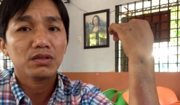 Sự thật khác về vụ con trai Giám đốc CA tỉnh Cà Mau đánh người